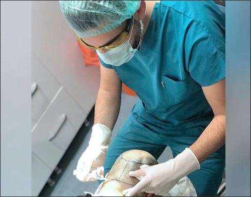 Pusat Pemindahan Rambut Hermest, Turki