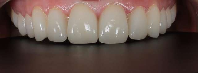 የጥርስ ህክምና መፍትሄዎች