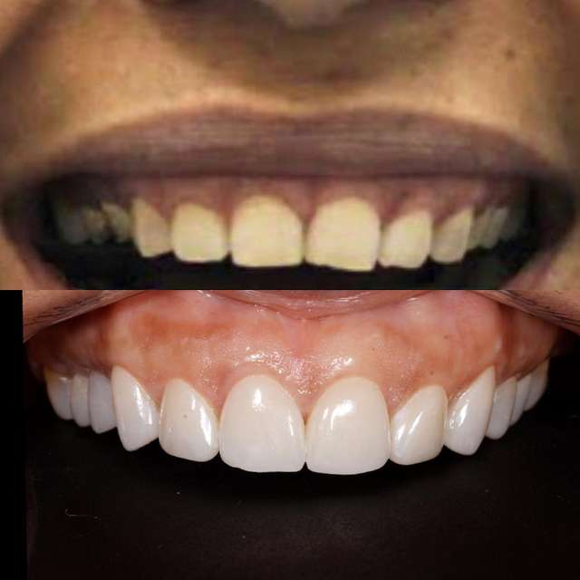 የጥርስ ህክምና መፍትሄዎች