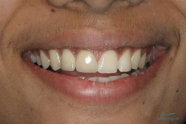 አስተማማኝ የጥርስ ህክምና