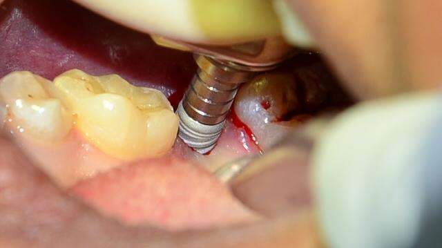 ተልዕኮ ፈገግታ