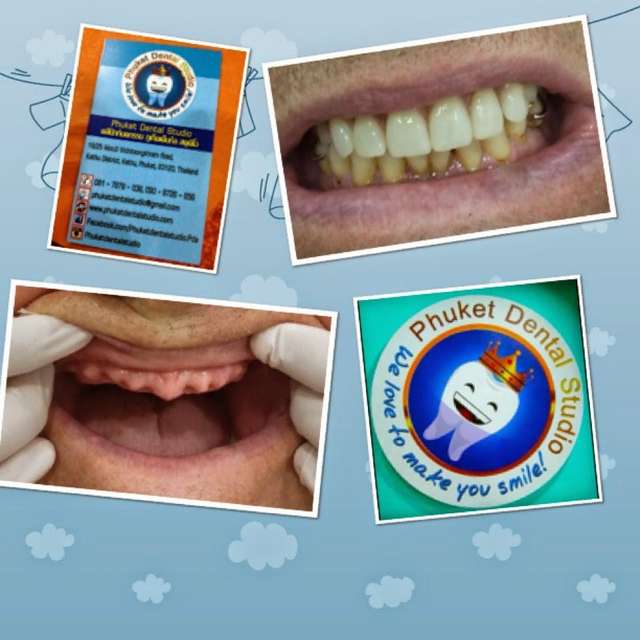 ፉኬት የጥርስ ስቱዲዮ