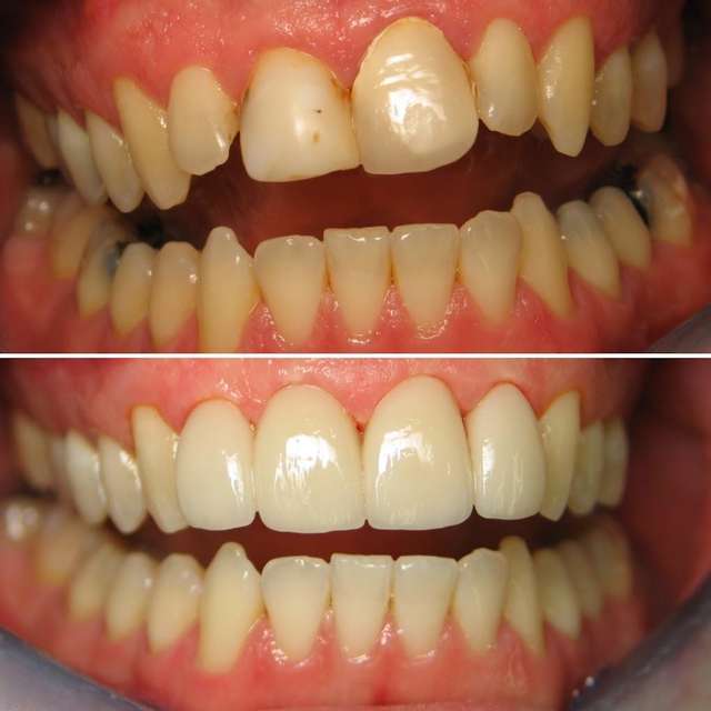 ብልጭልጭ የጥርስ ቡቲክ