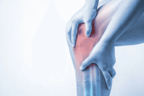 إجمالي استبدال الركبة (من جانب واحد)