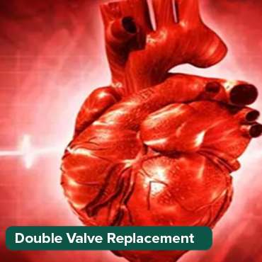 ድርብ ቫልቭ መተካት (DVR)