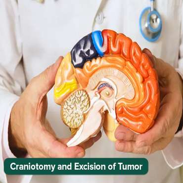 حج القحف لأورام الدماغ