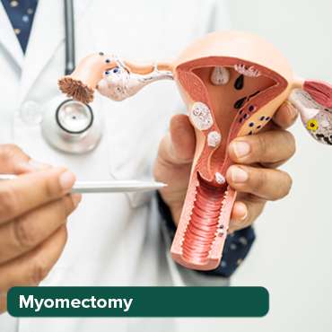 استئصال الجزئي