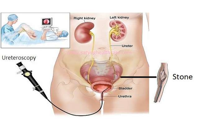دعامة DJ (ثنائية))