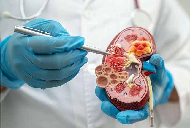 Kidney Function Package