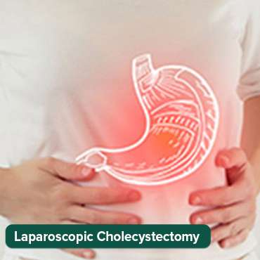 ላፓሮስኮፒክ ሳይስቴክቶሚ